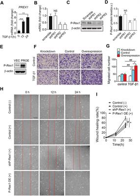 P-Rex1 Cooperates With TGFβR2 to Drive Lung <mark class="highlighted">Fibroblast Migration</mark> in Pulmonary Fibrosis